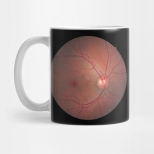 Eyebal X-ray Mug